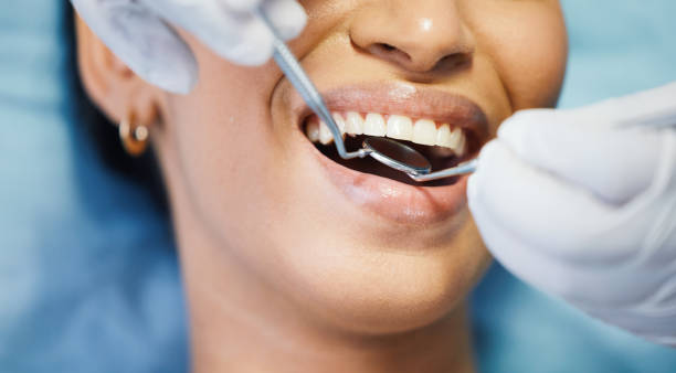 Best Emergency Tooth Extraction in Elton, LA